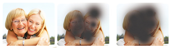 macular degeneration